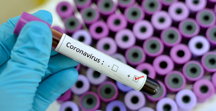 Pacientes com suspeita de coronavírus no Crato estão bem e em casa, afirma município