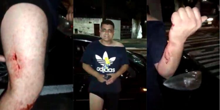Motorista de app fica ferido após ser assaltado por duas mulheres e uma adolescente em Fortaleza